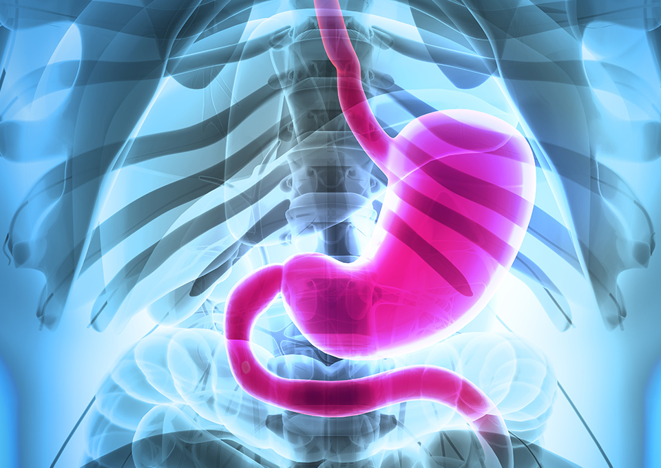 胃カメラでわかる病気の例